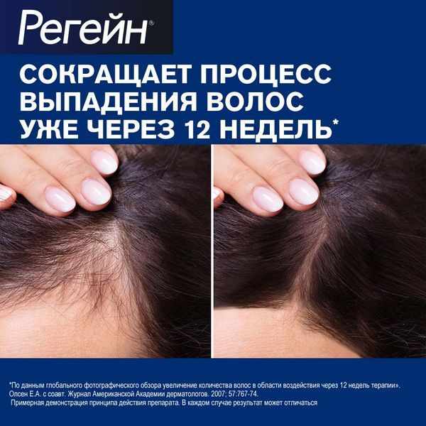 Регейн пена для наружного применения 5% баллон 60г №1
