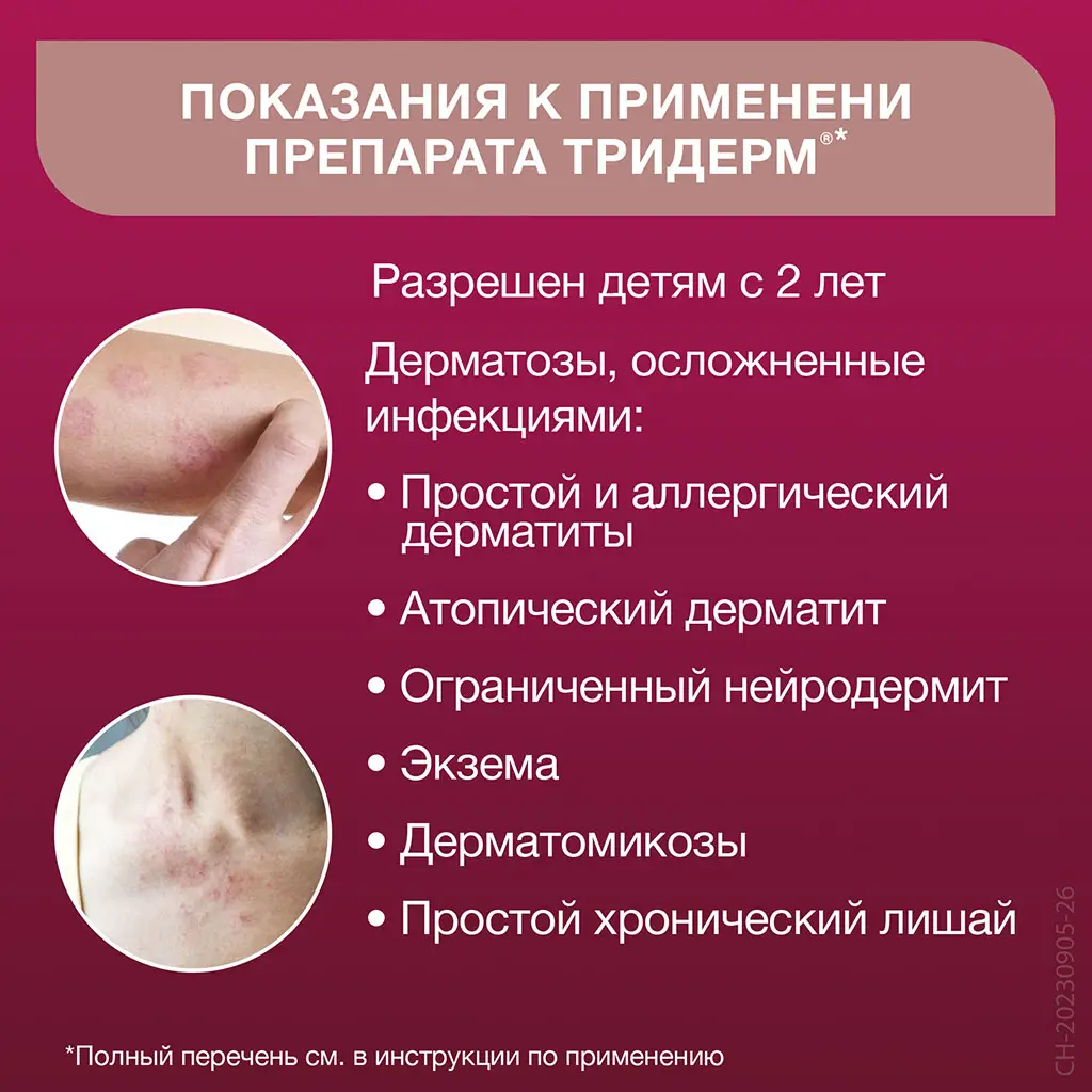 Тридерм крем для наружного применения 0,05%+0,1%+1% туба 15г 
